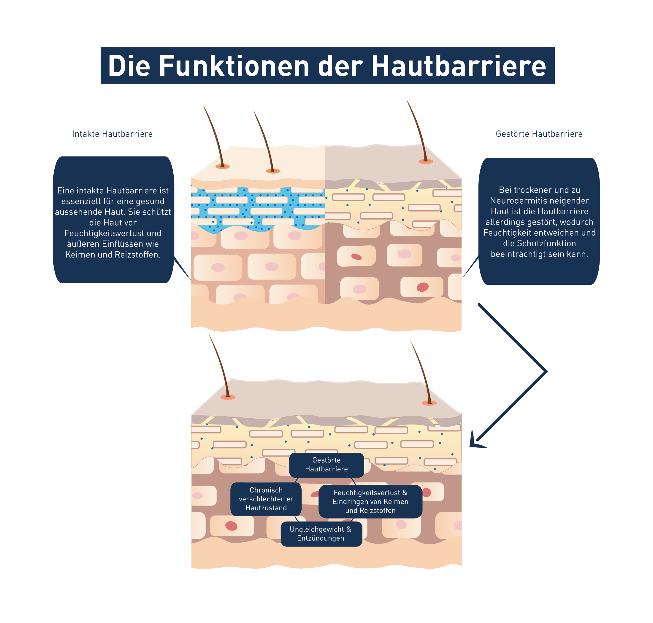Funktionen der Hautbarriere